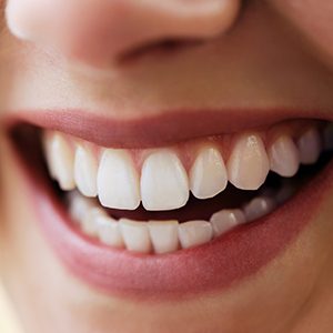 Closeup of flawless healthy teeth
