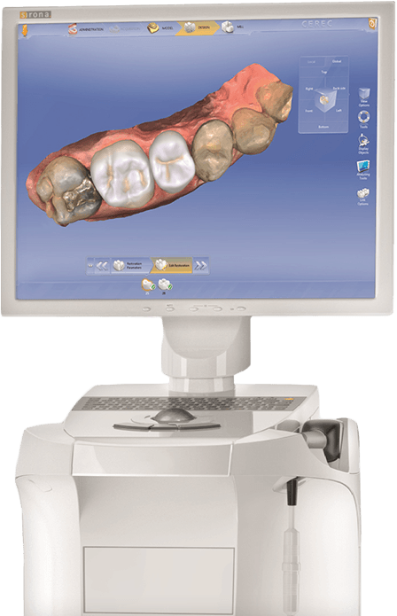 CEREC same day dental restoration design software